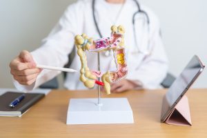 Prevenção do Câncer Colorretal: Quem, Quando e Como?