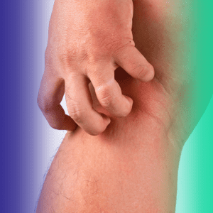 Celulite e erisipela: como diferenciar e por que isso importa no tratamento?