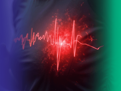 Fibrilação Atrial de início recente: o que você precisa saber?