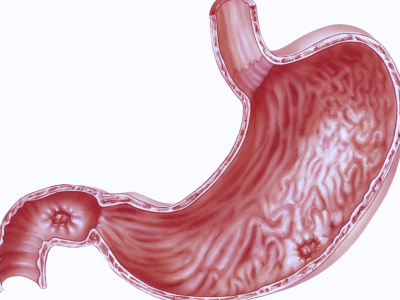Será o fim dos tratamentos ineficazes de H. pylori?